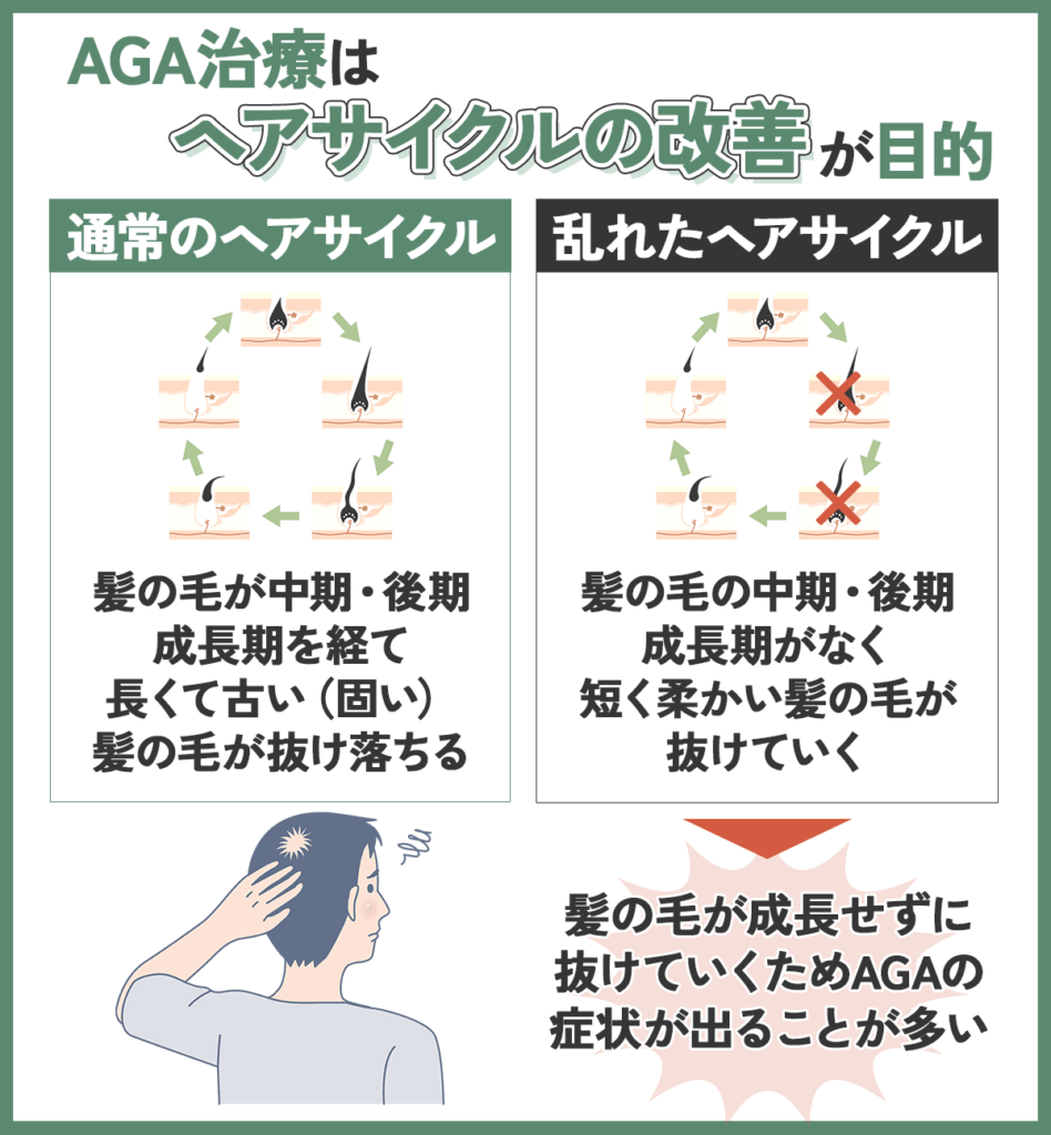 乱れたヘアサイクルの改善が重要