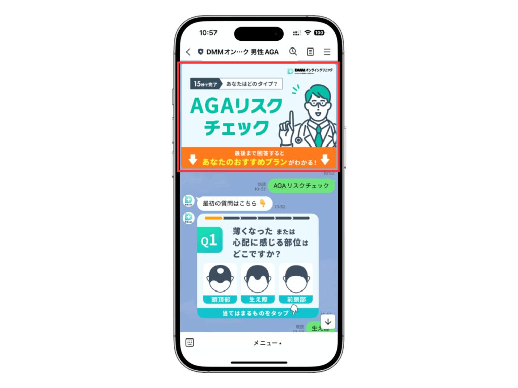 DMMおうちAGA公式LINEセルフチェック
