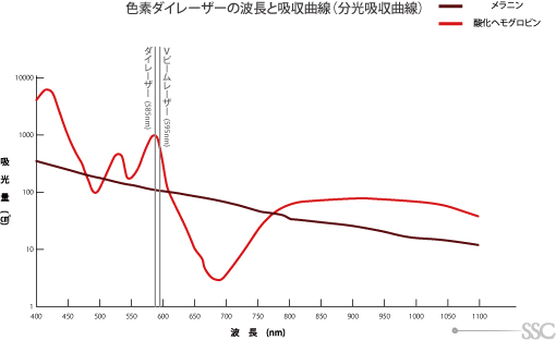 色素大レーザーの波長と強度