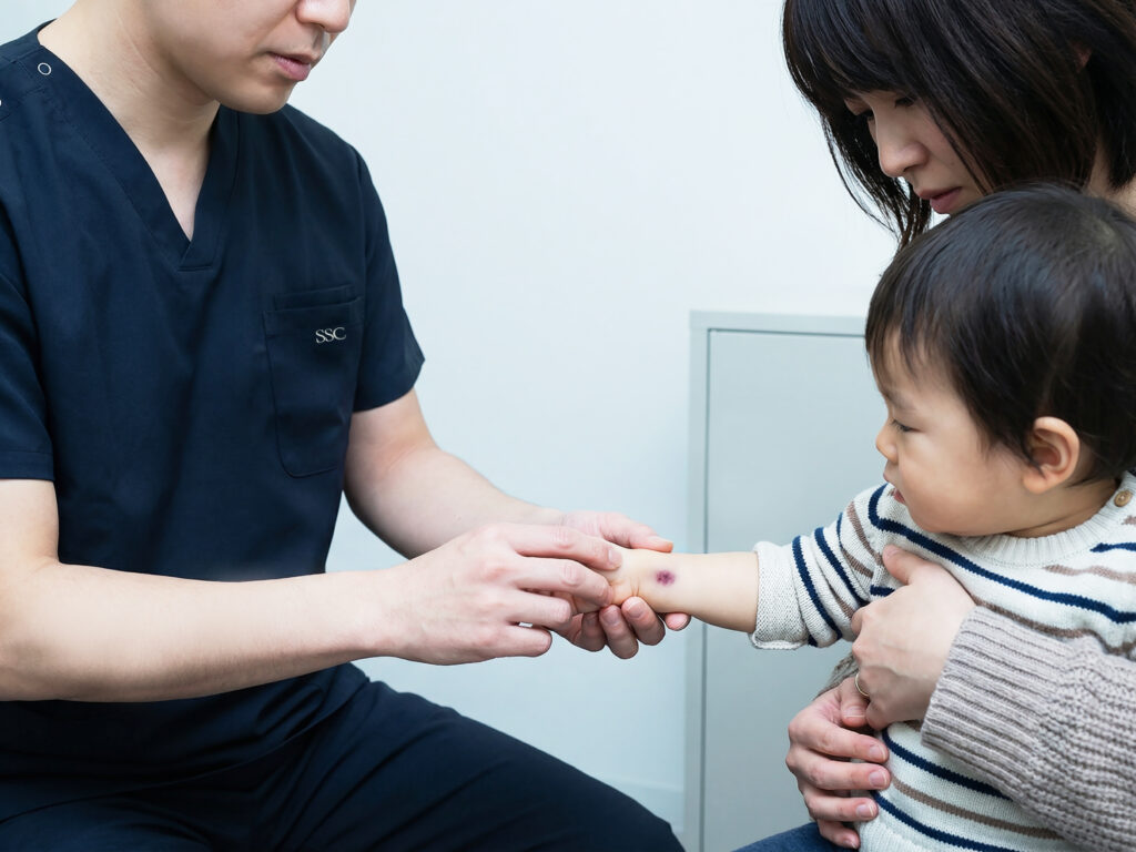 SSCクリニックの乳幼児のあざ治療について-アザ除去を始めるのに適した年齢